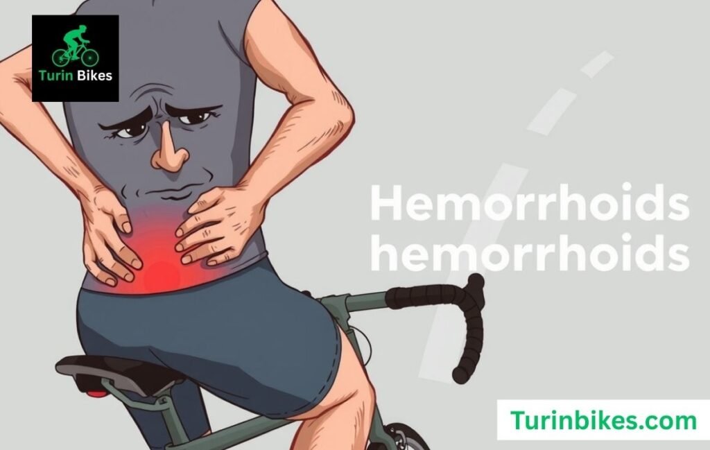 Cycling and Hemorrhoids